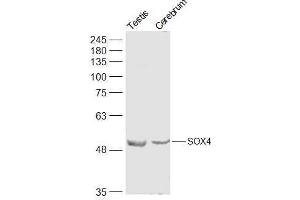 SOX4 antibody  (AA 54-103)