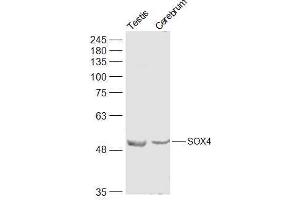 Lane 1: Mouse Testis lysates Lane 2: Mouse Cerebrum lysates probed with SOX4 Polyclonal Antibody, Unconjugated  at 1:500 dilution and 4˚C overnight incubation. (SOX4 antibody  (AA 54-103))
