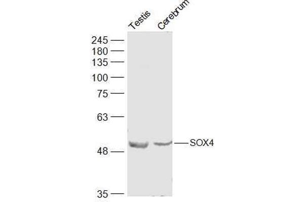 SOX4 抗体  (AA 54-103)