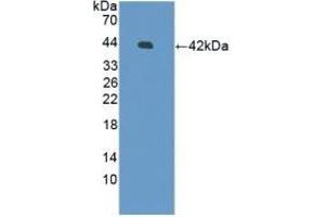 Detection of Recombinant DEFb126, Human using Polyclonal Antibody to Defensin Beta 126 (DEFb126) (DEFB126 antibody  (AA 21-111))