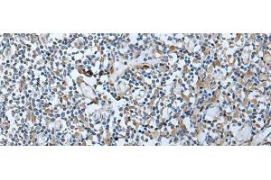 Immunohistochemistry of paraffin-embedded Human tonsil tissue using VDAC1 Polyclonal Antibody at dilution of 1:35(x200) (VDAC1 antibody)