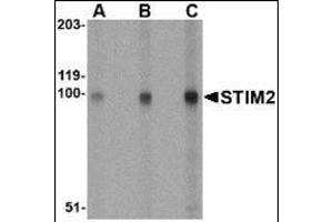 Western blot analysis of STIM2 in A-20 cell lysate with this product at (A) 0. (Stim2 antibody  (Center))