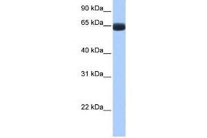 Human Lung; WB Suggested Anti-ARHGAP28 Antibody Titration: 0. (ARHGAP28 antibody  (C-Term))