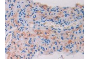Used in DAB staining on fromalin fixed paraffin- embedded stomach tissue (Aconitase 1 antibody  (AA 527-719))