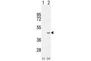 Western blot analysis of COCH (arrow) using rabbit polyclonal COCH Antibody (C-term) . (COCH antibody  (C-Term))