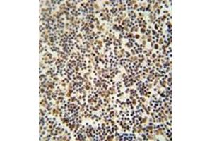 Formalin fixed, paraffin embedded human lymph tissue stained with DENND1B Antibody (N-term) followed by peroxidase conjugation of the secondary antibody and DAB staining. (DENND1B antibody  (N-Term))