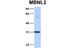Host:  Rabbit  Target Name:  MBNL2  Sample Type:  Human Fetal Heart  Antibody Dilution:  1.