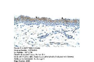 Immunohistochemistry (IHC) image for anti-serpin Peptidase Inhibitor, Clade B (Ovalbumin), Member 5 (SERPINB5) (Middle Region) antibody (ABIN2777125)