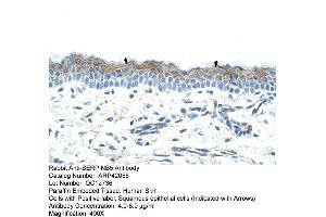 Rabbit Anti-SERPINB5 Antibody  Paraffin Embedded Tissue: Human Skin Cellular Data: Squamous epithelial cells Antibody Concentration: 4. (SERPINB5 antibody  (Middle Region))