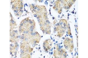 Immunohistochemistry of paraffin-embedded Human stomach using PLEK Polyclonal Antibody at dilution of 1:200 (40x lens). (Pleckstrin antibody)