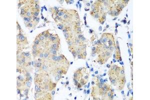 Immunohistochemistry of paraffin-embedded Human stomach using PLEK Polyclonal Antibody at dilution of 1:200 (40x lens).