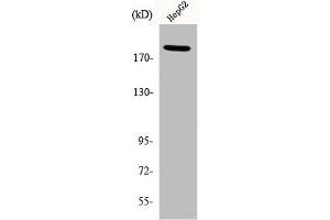 Western Blot analysis of HepG2 cells using Phospho-IRS-1 (S312) Polyclonal Antibody (IRS1 antibody  (pSer312))
