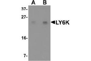 Western blot analysis of LY6K in HeLa cell lysate with LY6K Antibody  at (A) 1 and (B) 2 μg/ml.