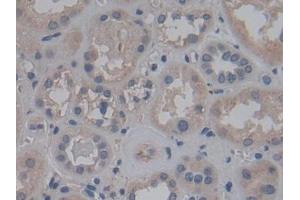 Detection of FGF12 in Human Kidney Tissue using Polyclonal Antibody to Fibroblast Growth Factor 12 (FGF12) (FGF12 antibody  (AA 1-181))