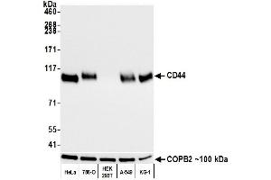 Western Blotting (WB) image for anti-CD44 (CD44) (AA 700-742) antibody (ABIN7454002) (Recombinant CD44 antibody  (AA 700-742))