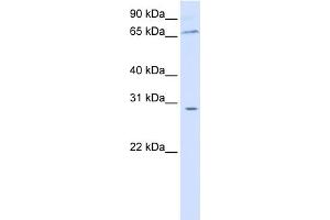 WB Suggested Anti-ZBTB48 Antibody Titration: 0. (ZBTB48 antibody  (N-Term))