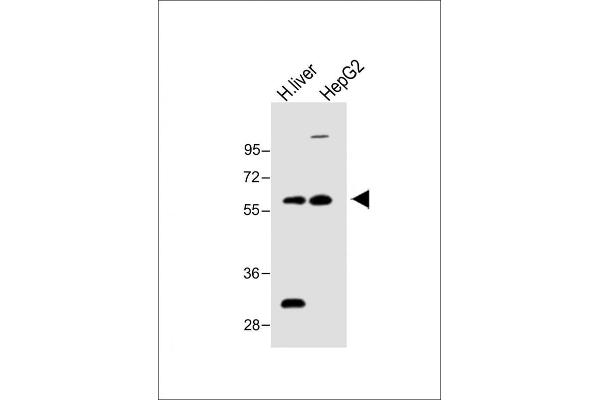FADS2 anticorps  (N-Term)