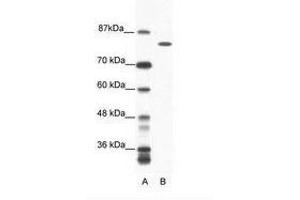 Image no. 1 for anti-DEAH (Asp-Glu-Ala-His) Box Polypeptide 16 (DHX16) (AA 352-401) antibody (ABIN6736054) (DHX16 antibody  (AA 352-401))