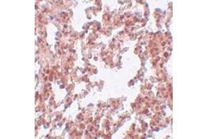 Immunohistochemistry (IHC) image for anti-Sushi-Repeat Containing Protein, X-Linked 2 (SRPX2) (N-Term) antibody (ABIN1031586)