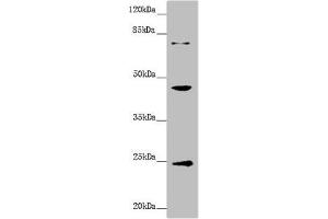 Western blot All lanes: GNA15 antibody at 1. (GNA15 antibody  (AA 1-374))