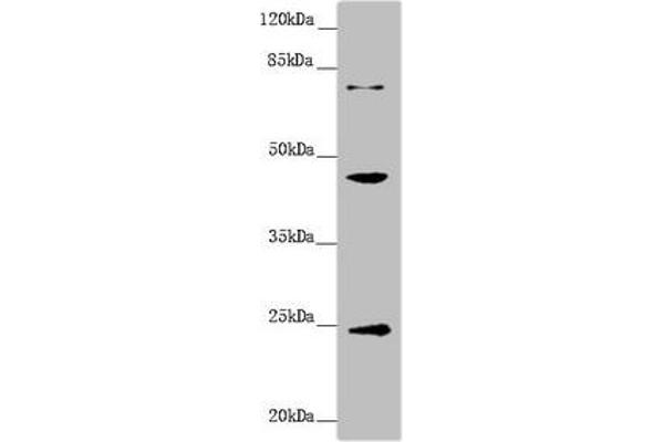 GNA15 anticorps  (AA 1-374)