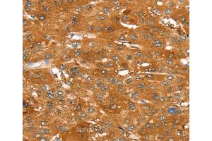 Immunohistochemistry (IHC) image for anti-ATP-Binding Cassette, Sub-Family C (CFTR/MRP), Member 9 (ABCC9) antibody (ABIN2433955) (ABCC9 antibody)