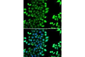 Immunofluorescence analysis of MCF-7 cells using RNF7 antibody (ABIN4905022).