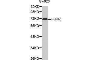 Western blot analysis of extracts of Sw626 cell line,using FSHR antibody. (FSHR antibody)