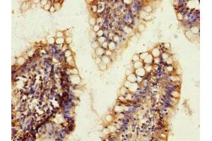 Immunohistochemistry of paraffin-embedded human small intestine tissue using ABIN7143394 at dilution of 1:100 (LPHN2 antibody  (AA 400-480))