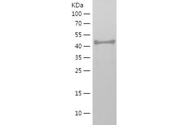 NXN Protein (AA 127-327) (His-IF2DI Tag)