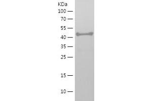 Western Blotting (WB) image for Nucleoredoxin (NXN) (AA 127-327) protein (His-IF2DI Tag) (ABIN7124225) (NXN Protein (AA 127-327) (His-IF2DI Tag))