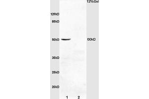 L1 rat kidney lysates L2 mouse colon carcinoma lysates probed with Anti IL-2R gamma/CD132 Polyclonal Antibody, Unconjugated (ABIN731993) at 1:200 overnight at 4 °C. (PDCD4 antibody  (AA 1-100))
