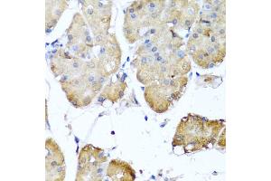 Immunohistochemistry of paraffin-embedded human stomach using NIN antibody (ABIN5974918) at dilution of 1/100 (40x lens). (Ninein antibody)