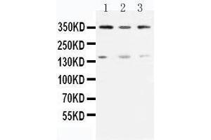 Anti-ATM antibody, Western blotting Lane 1: Rat Testis Tissue Lysate Lane 2: U87 Cell Lysate Lane 3: MCF-7 Cell Lysate (ATM antibody  (N-Term))