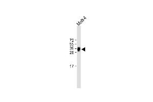 All lanes : Anti-TRBC1 Antibody (Center) at 1:500 dilution Lane 1: Molt-4 whole cell lysate Lysates/proteins at 20 μg per lane. (TRBC1 antibody  (AA 104-136))