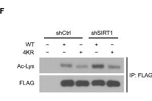 Western Blotting (WB) image for anti-Acetylated Lysine antibody (ABIN5596809)