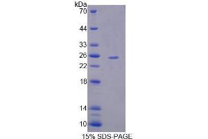 SDS-PAGE analysis of Human USP2 Protein.