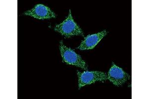 Confocal immunofluorescent analysis of ADCY Antibody (C-term) (ABIN651855 and ABIN2840424) with 293 cell followed by Alexa Fluor? (PACAP antibody  (C-Term))