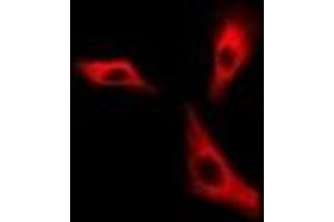Immunofluorescent analysis of H6PD staining in A549 cells. (Glucose-6-Phosphate Dehydrogenase antibody)