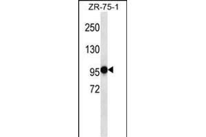 PHF14 Antibody (N-term) (ABIN656972 and ABIN2846155) western blot analysis in ZR-75-1 cell line lysates (35 μg/lane). (PHF14 antibody  (N-Term))