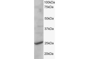 ABIN184844 staining (1µg/ml) of human liver lysate (RIPA buffer, 35µg total protein per lane). (CYB561D2 antibody  (C-Term))