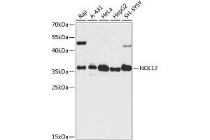 Western blot analysis of extracts of various cell lines, using NOL12 antibody  at 1:3000 dilution. (NOL12 antibody  (AA 1-213))