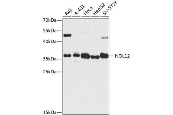 NOL12 抗体  (AA 1-213)