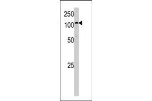 Western blot analysis of HK1 polyclonal antibody  in A-375 cell lysate.