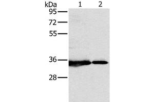 Western Blotting (WB) image for anti-NADH Dehydrogenase (Ubiquinone) 1 alpha Subcomplex, Assembly Factor 1 (NDUFAF1) antibody (ABIN7237484)