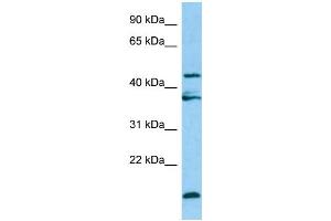 WB Suggested Anti-LGMN Antibody Titration: 1. (LGMN antibody  (Middle Region))
