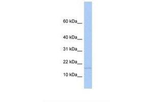 Image no. 1 for anti-Mediator Complex Subunit 21 (MED21) (AA 74-123) antibody (ABIN6737805) (MED21 antibody  (AA 74-123))