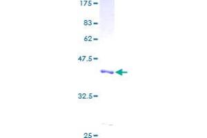 Image no. 1 for Fatty Acid Binding Protein 1, Liver (FABP1) (AA 1-127) protein (GST tag) (ABIN1353338) (FABP1 Protein (AA 1-127) (GST tag))