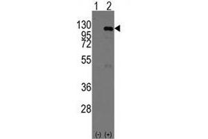 Western blot analysis of CASC3 (arrow) using rabbit polyclonal CASC3 Antibody (Mouse C-term) . (CASC3 antibody  (C-Term))