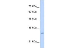 Western Blotting (WB) image for anti-Myeloid Leukemia Factor 2 (MLF2) antibody (ABIN2462989) (MLF2 antibody)